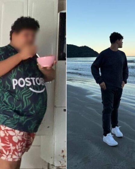Obesidade infantil cresce no Brasil: um em cada três adolescentes com sobrepeso