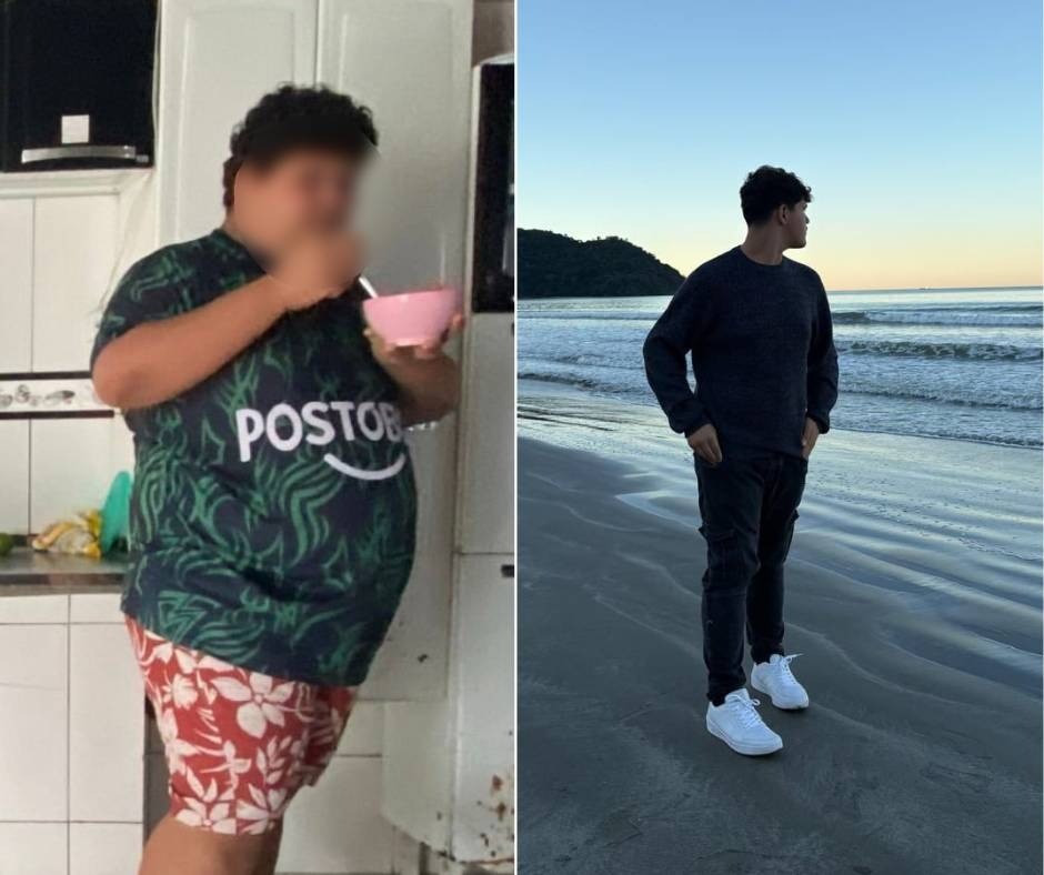 Obesidade infantil cresce no Brasil: um em cada três adolescentes com sobrepeso